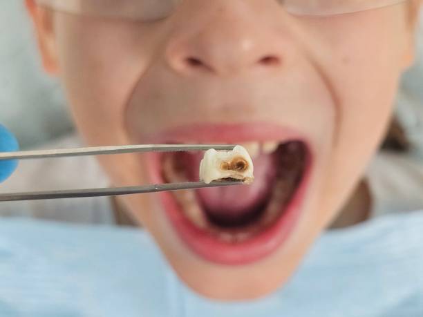 Best Broken Tooth Emergency  in St Joseph, MI